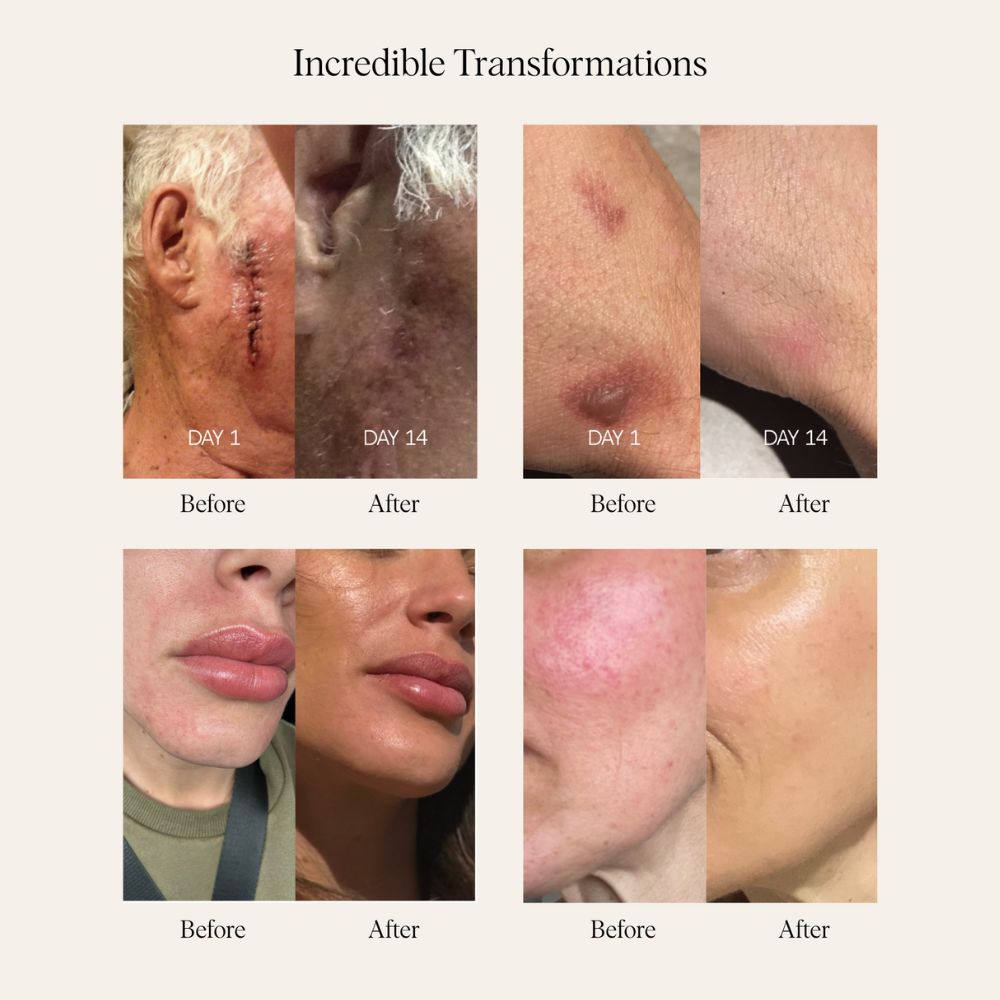 Sea Buckthorn Serum - 30ml/1 fl. oz