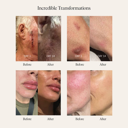 Sea Buckthorn Serum - 30ml/1 fl. oz