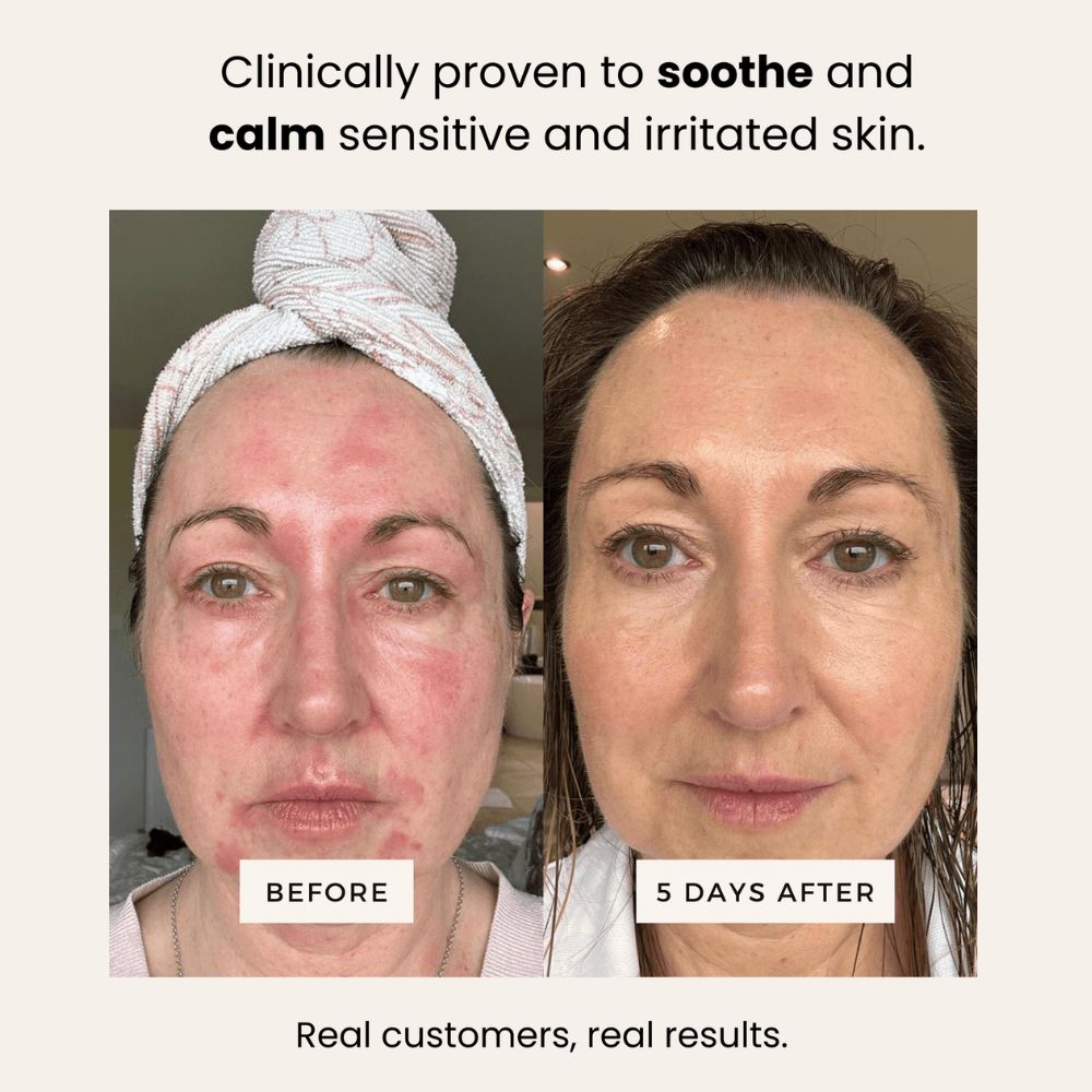 Sea Buckthorn Serum - 30ml/1 fl. oz