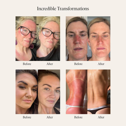 Sea Buckthorn Serum - 30ml/1 fl. oz