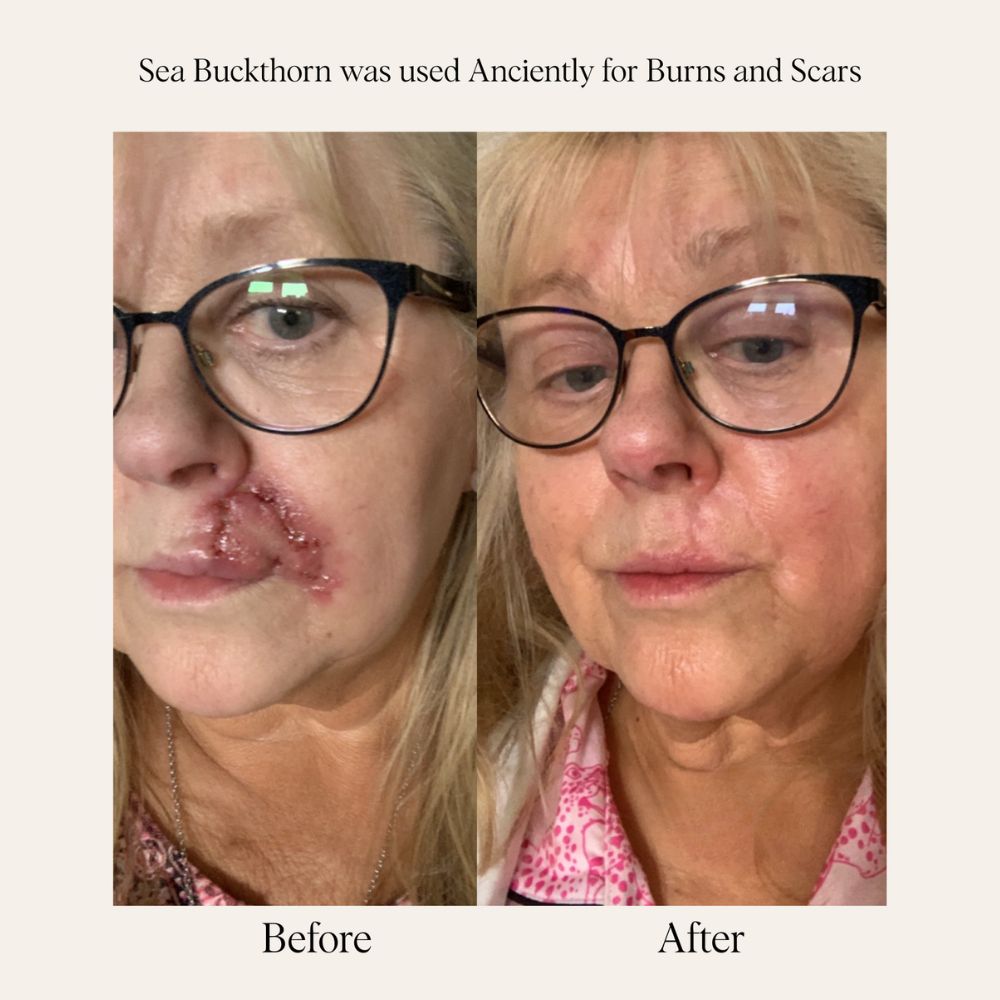 Sea Buckthorn Serum - 30ml/1 fl. oz