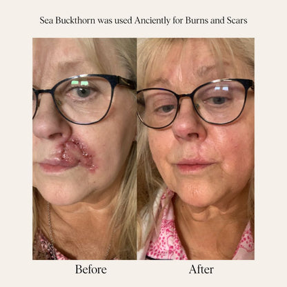 Sea Buckthorn Serum - 30ml/1 fl. oz